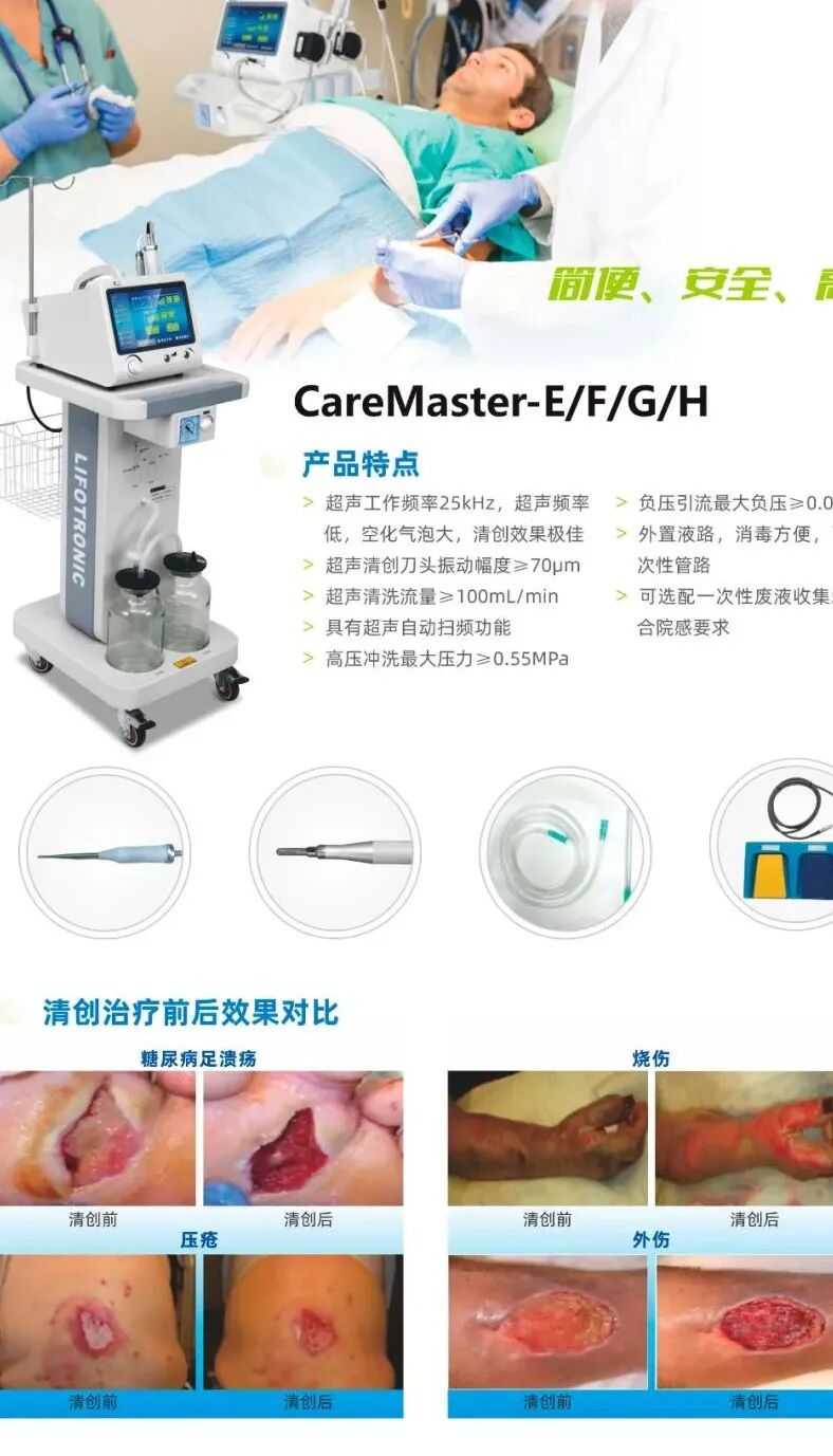 清创仪器怎么使用多功能清创机 ｜ 小小超声清创机 解决患者大问题_https://www.jmylbn.com_新闻资讯_第5张