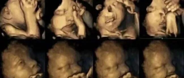 8岁女孩肺癌晚期！我拼尽全力保护孩子，你却轻而易举当了杀手