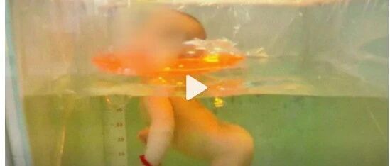 痛心！刚满月女婴在家人监护下游泳居然窒息身亡！医生发出这些提醒...