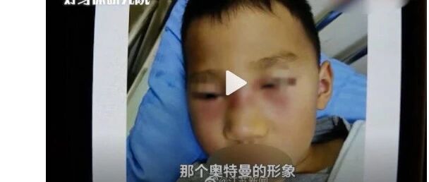 快制止！90%孩子都有的这个小习惯居然可能导致颅内感染！