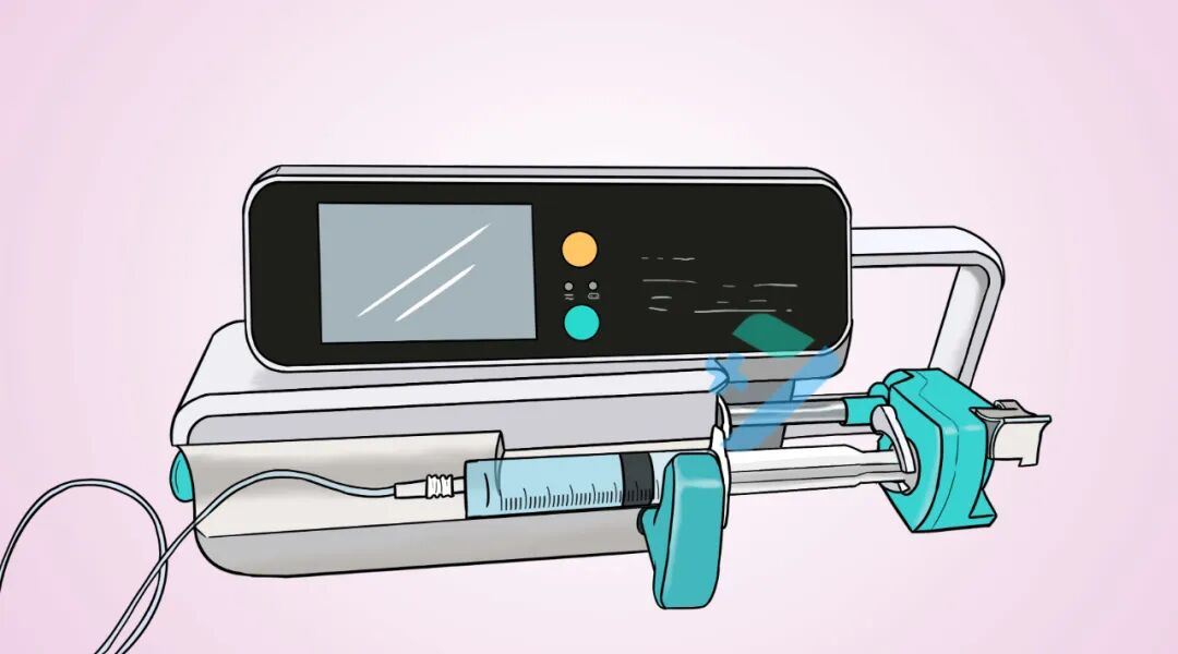 为什么微量泵会响微泵给药的这5大常见问题，千万别大意！_https://www.jmylbn.com_新闻资讯_第4张