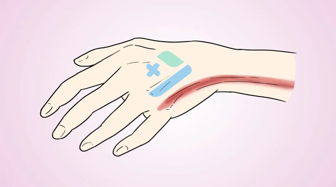 加压输液什么意思输液反应抢救大全，学会了能救命！_https://www.jmylbn.com_新闻资讯_第7张