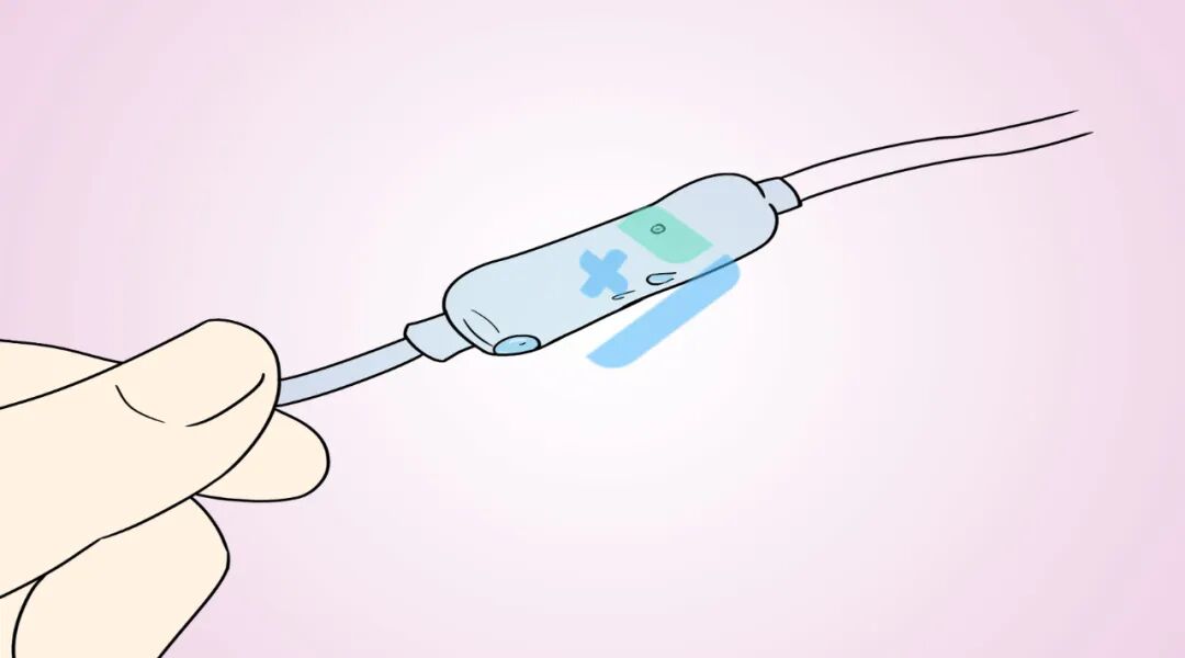 加压输液什么意思输液反应抢救大全，学会了能救命！_https://www.jmylbn.com_新闻资讯_第9张