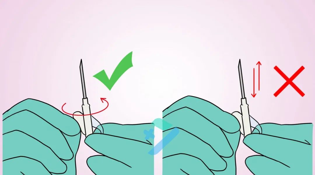 留置针软管断裂入血你不得不知的紧急处理措施