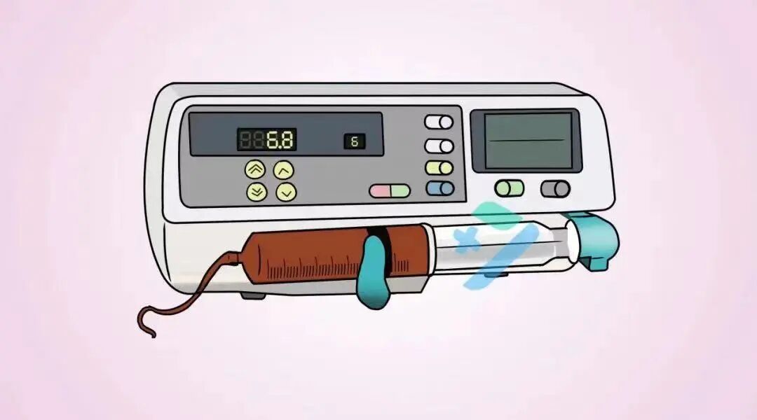 为什么微量泵会响微泵输注血管活性药物，这些危险因素千万要知道！_https://www.jmylbn.com_新闻资讯_第3张