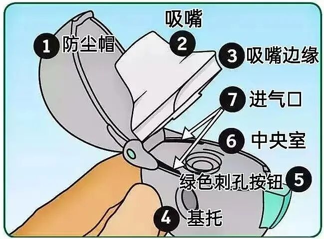 新呼泰怎么用常用几种吸入制剂的使用方法，你会了吗？_https://www.jmylbn.com_新闻资讯_第25张