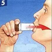 新呼泰怎么用常用几种吸入制剂的使用方法，你会了吗？_https://www.jmylbn.com_新闻资讯_第87张