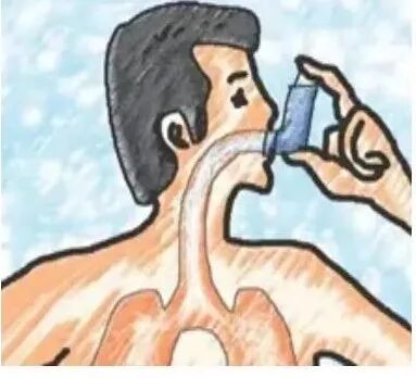 新呼泰怎么用常用几种吸入制剂的使用方法，你会了吗？_https://www.jmylbn.com_新闻资讯_第17张