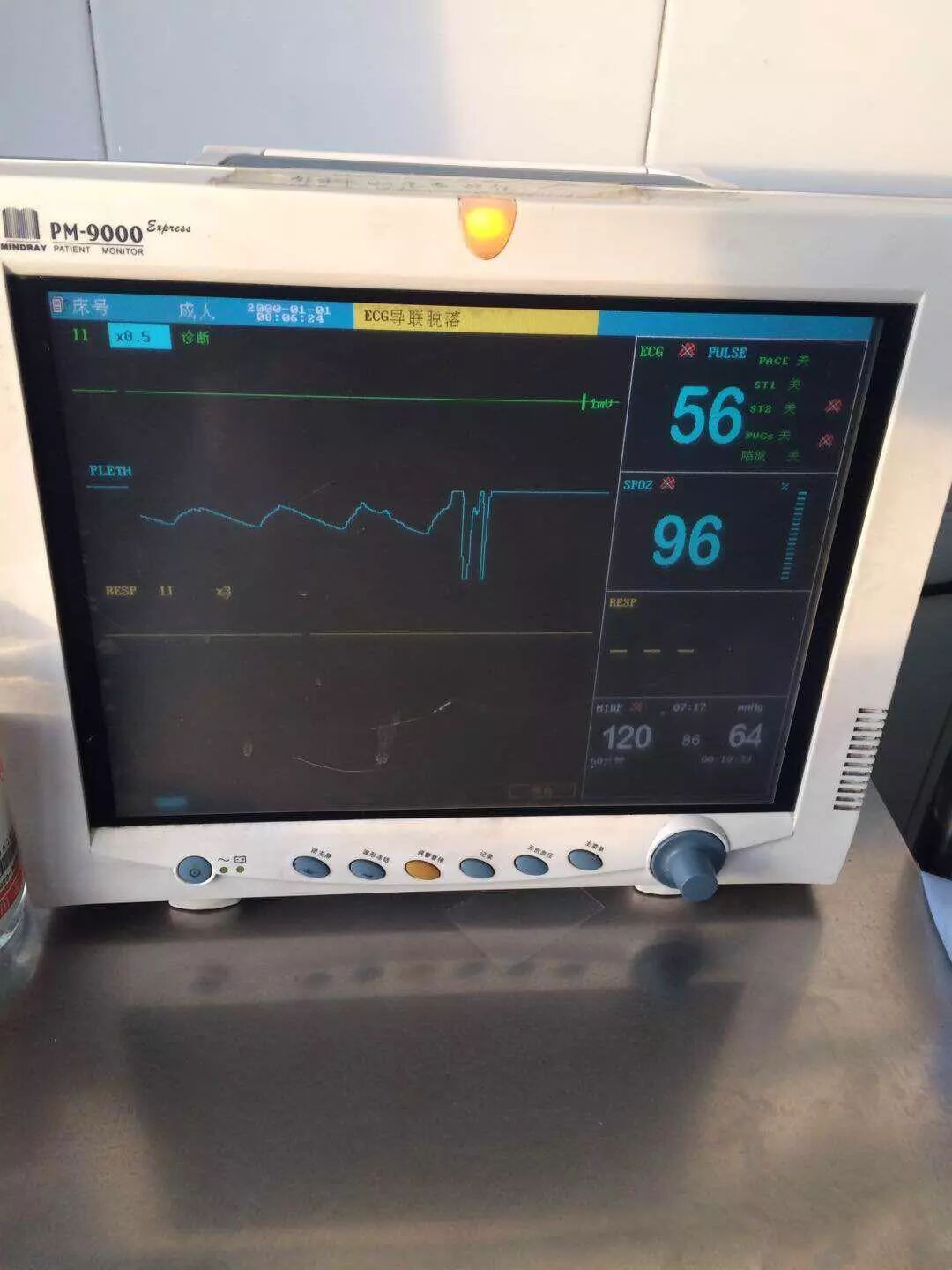 心电监护仪怎么贴急诊心电监护仪天天用，这些问题要清楚？_https://www.jmylbn.com_新闻资讯_第7张