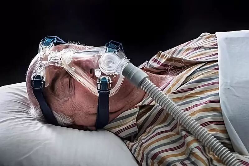 压缩气怎么雾化【专家共识】机械通气时雾化吸入_https://www.jmylbn.com_新闻资讯_第7张