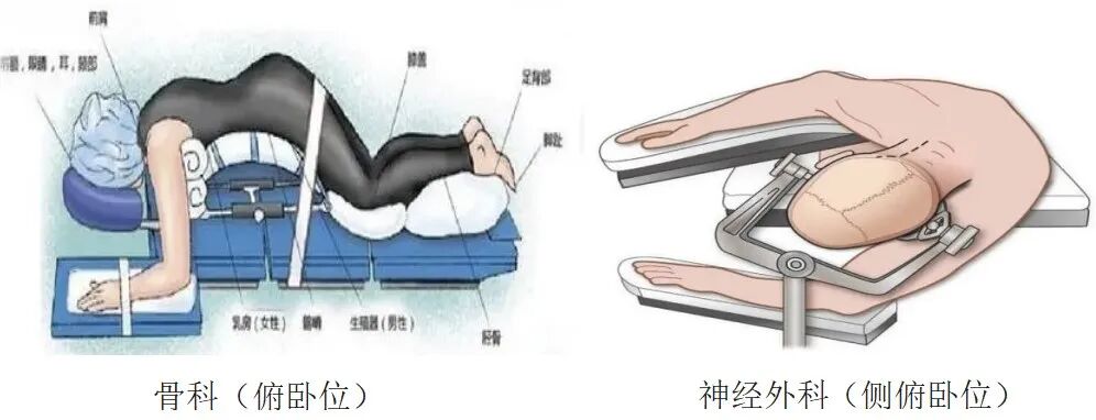手术器械设备怎么读【文献解读】手术室器械相关压力性损伤预防的最佳证据总结_https://www.jmylbn.com_新闻资讯_第10张