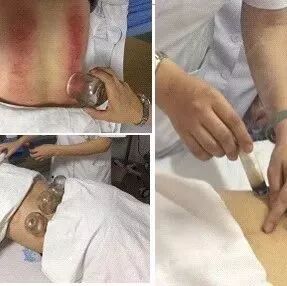 作为西医院里的中医科护士，你适应了么？