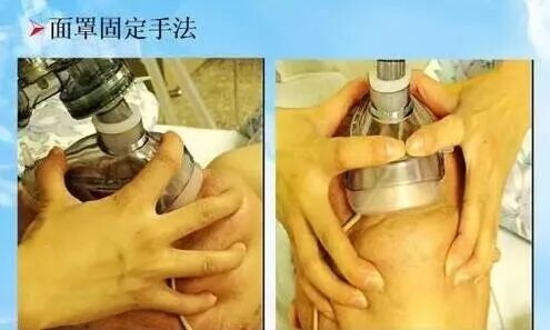 比样呼吸器怎么样简易呼吸气囊使用有效的指征，你会正确使用吗？_https://www.jmylbn.com_新闻资讯_第9张
