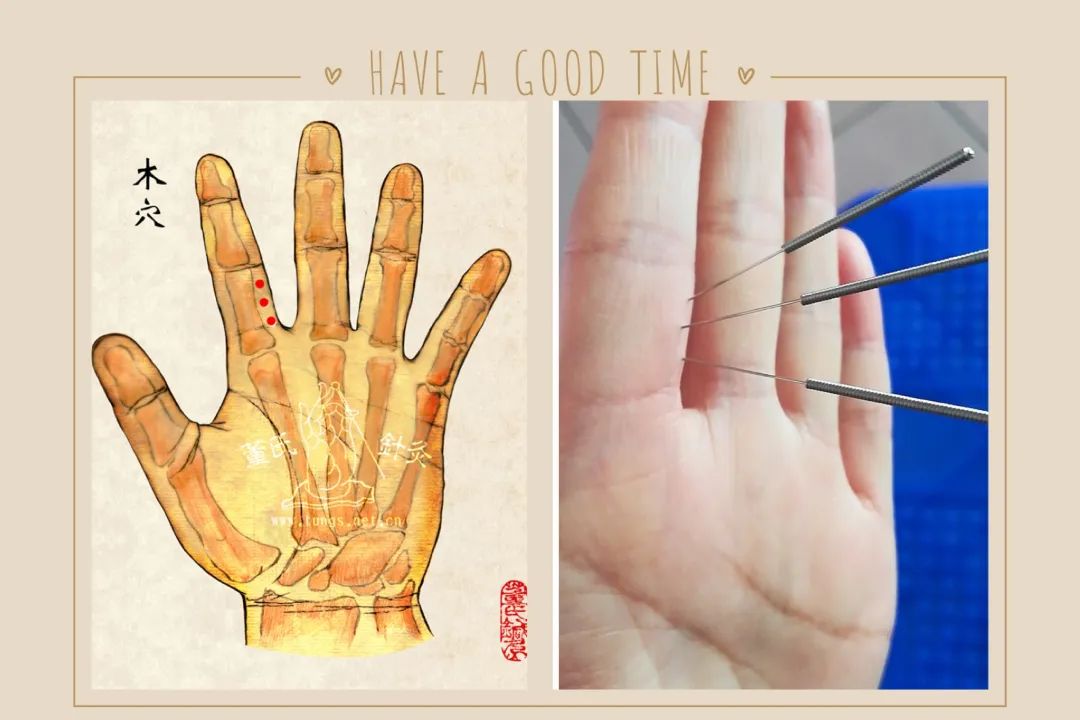 平乡董氏奇穴针灸培训班鼻科病症