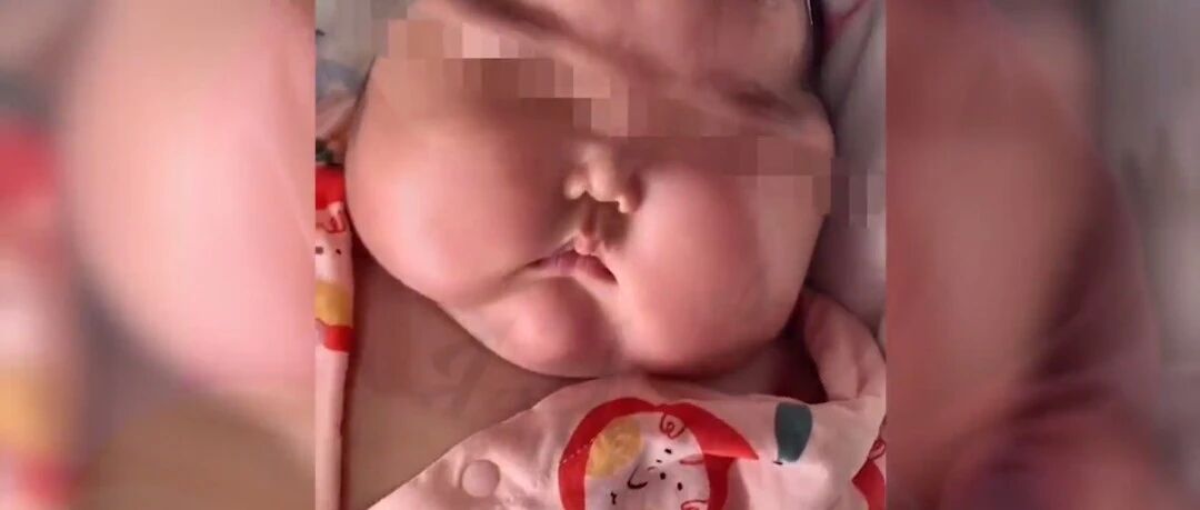 刷屏！5月女婴用面霜后变“大头娃娃”，脸硬得像石头！