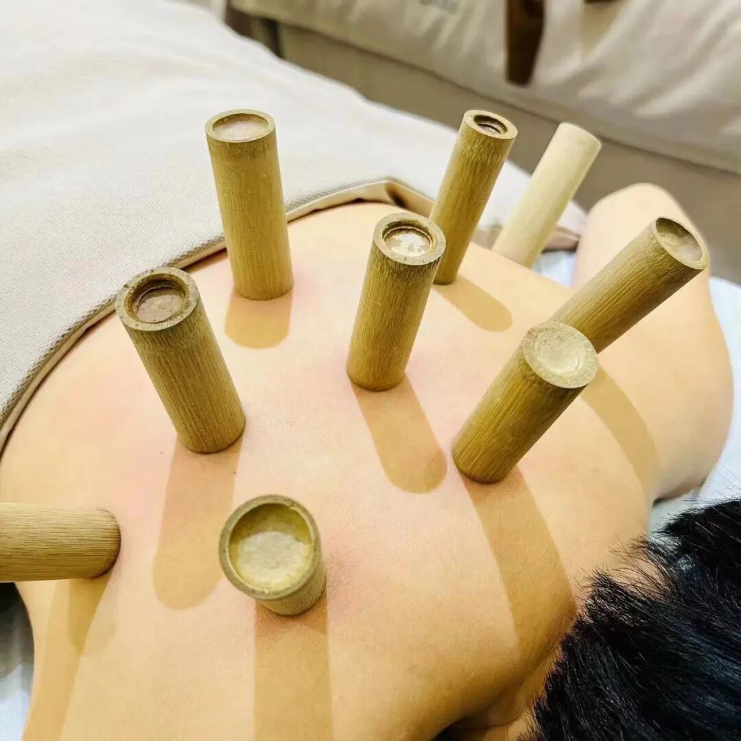 竹火罐怎么用在这个秋天捡到了“竹药罐”_https://www.jmylbn.com_新闻资讯_第7张