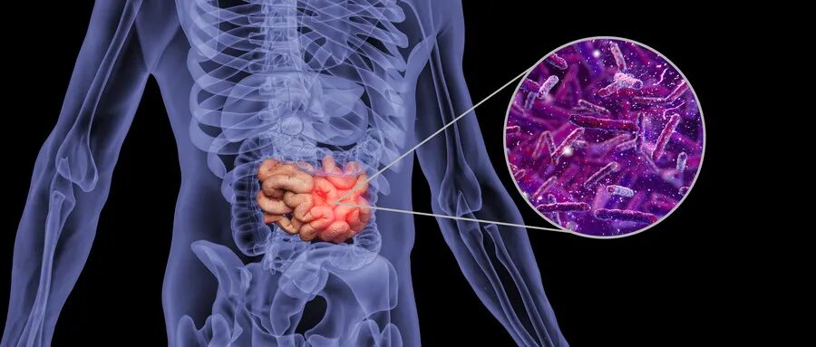 注意！身体出现这些症状，一定要警惕结直肠癌！