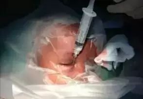 大胖小子」出生六天睜不開眼，媽媽在手術室里跪求醫生放棄治療 親子 第2張