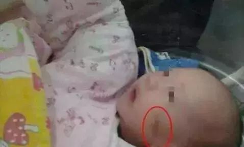 大胖小子」出生六天睜不開眼，媽媽在手術室里跪求醫生放棄治療 親子 第4張