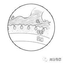 导尿管上fr是什么意思间歇性导尿管种类及型号简介_https://www.jmylbn.com_新闻资讯_第4张