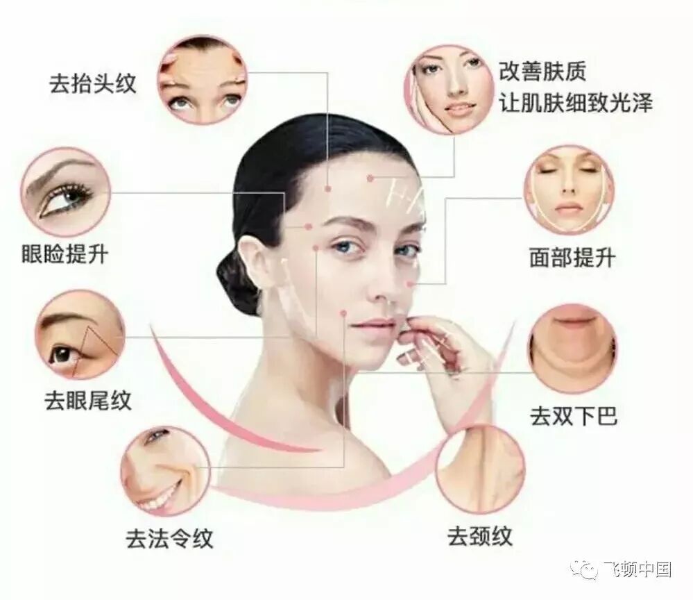 多极射频是什么【科普】射频RF应用于医美抗衰发展历程_https://www.jmylbn.com_新闻资讯_第2张