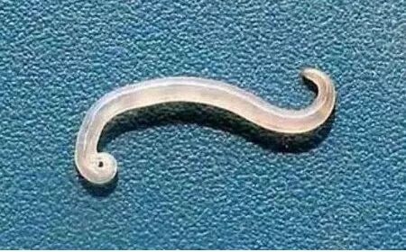 弓形虫鞭虫钩虫绦虫蛔虫常见的体内寄生虫大概有以下几种会有哪些表现