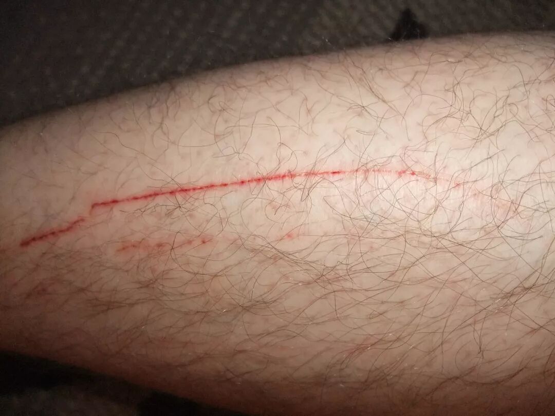 抓痕爪子一伸,小腿一蹦仅在夏天上岗纹身师@coyg狗界渣男人中爱宠就是