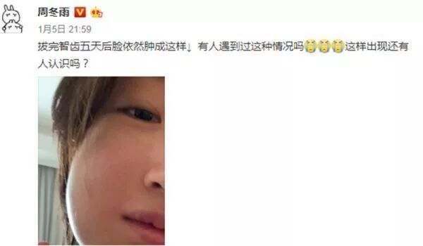 7个月孕妈呼吸困难，引发败血症！竟是因一颗牙！医生：这种情况