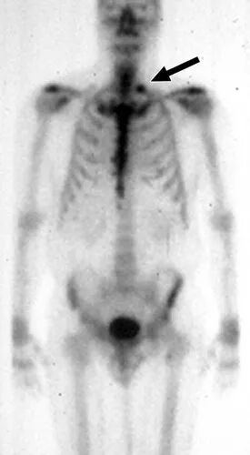 肋骨病变ct总结 多图 乐康a医聊 微信公众号文章阅读 Wemp