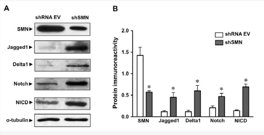什么是特定蛋白实验中最常说的“跑个条带看看”是什么意思——Western blot ｜ 科研技术速递_https://www.jmylbn.com_新闻资讯_第6张