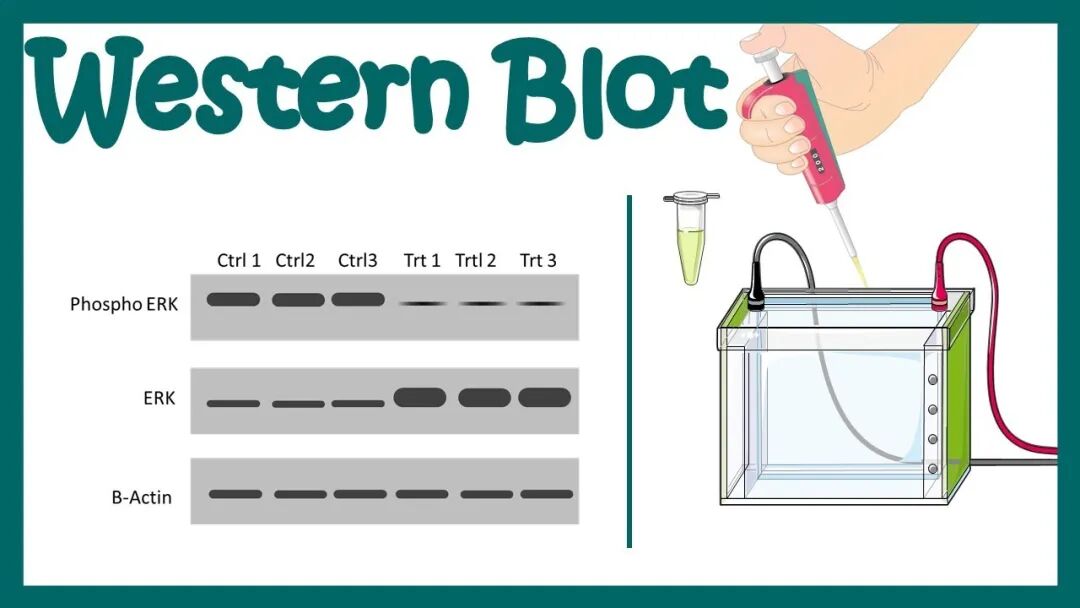 什么是特定蛋白实验中最常说的“跑个条带看看”是什么意思——Western blot ｜ 科研技术速递_https://www.jmylbn.com_新闻资讯_第2张