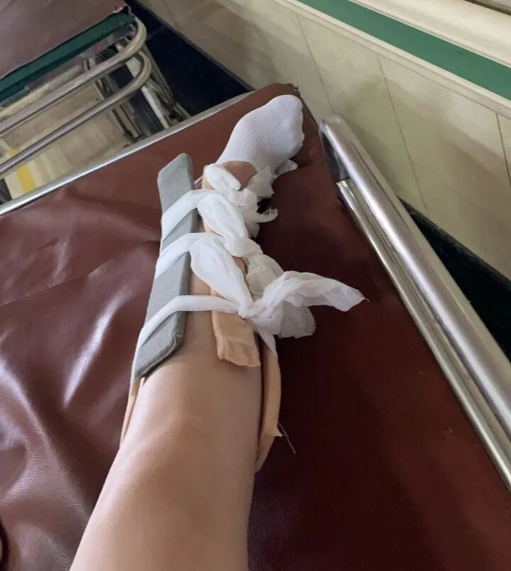 知名综艺录制现场突发意外！多人摔骨折，节目组不赔钱？