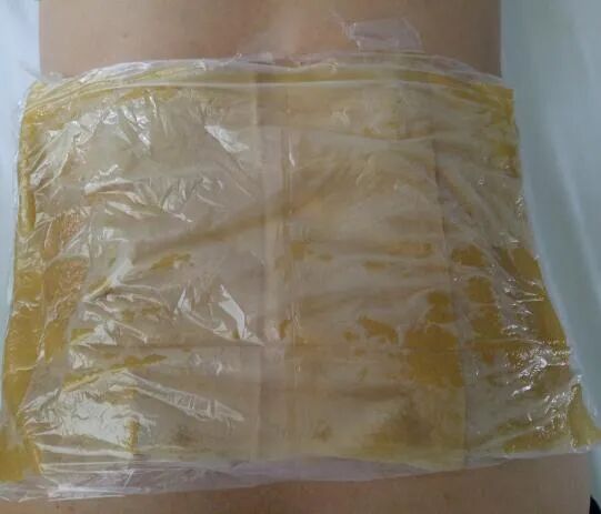 中药熏蒸床用什么药好【特色重点专科】齐鲁中医药优势专科——治未病中心_https://www.jmylbn.com_新闻资讯_第28张