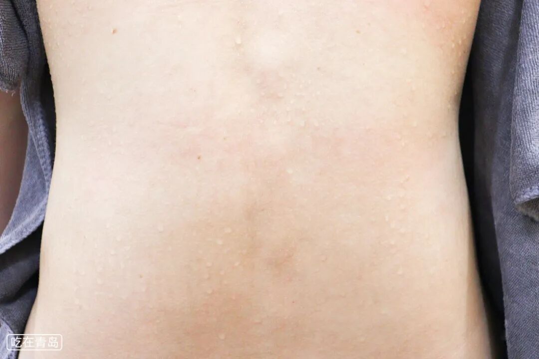 理疗熏蒸室怎么开周末来放松！按摩+古法熏蒸...⑤个项目90分钟，99元购！_https://www.jmylbn.com_新闻资讯_第22张