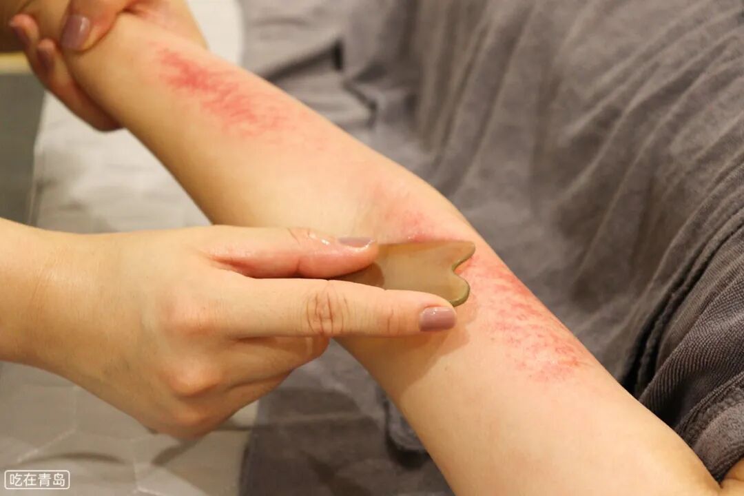 理疗熏蒸室怎么开周末来放松！按摩+古法熏蒸...⑤个项目90分钟，99元购！_https://www.jmylbn.com_新闻资讯_第42张