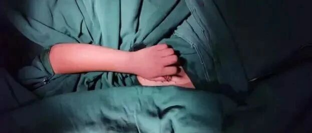 一阵风吹过，浙江5岁女娃的手指断了！血肉模糊中，母亲“神操作”被医生点赞