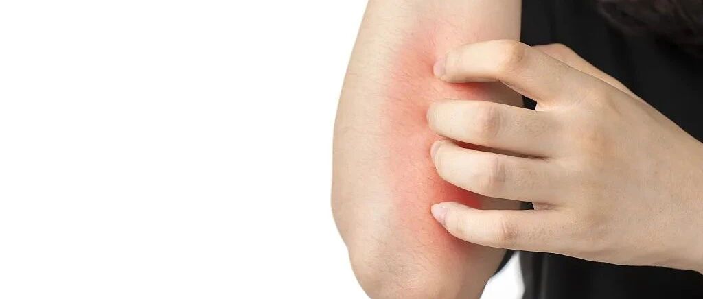 晚上痒得根本睡不着……大学寝室四人同患一种病，元凶竟是这种小虫子