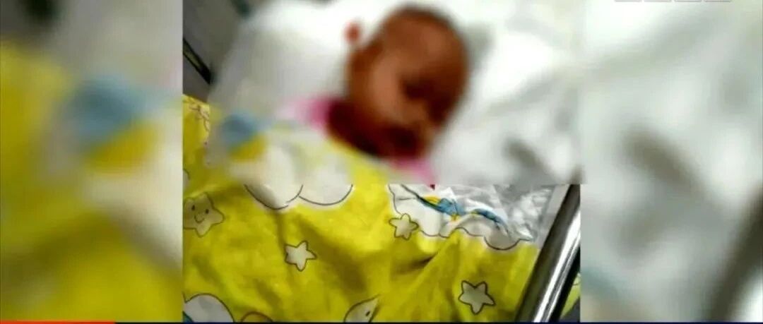 吃了这个后，一岁半宝宝被送进ICU，昏迷近十天！妈妈手足无措：都怪我......