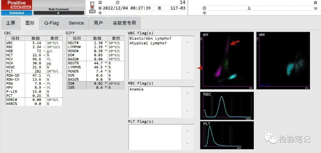 rbc直方图怎么看“实战演练”——用血常规散点图判断异常结果_https://www.jmylbn.com_新闻资讯_第5张