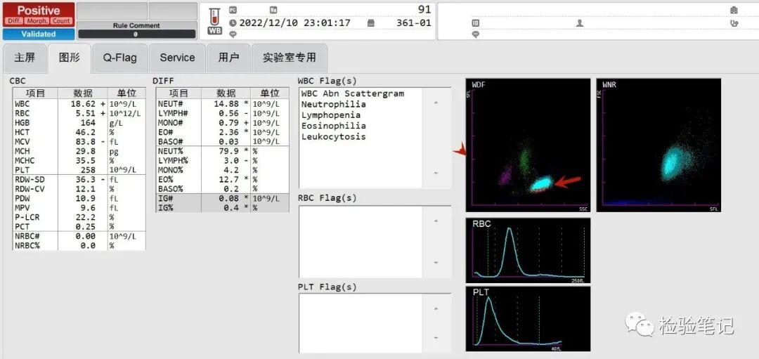 rbc直方图怎么看“实战演练”——用血常规散点图判断异常结果_https://www.jmylbn.com_新闻资讯_第6张
