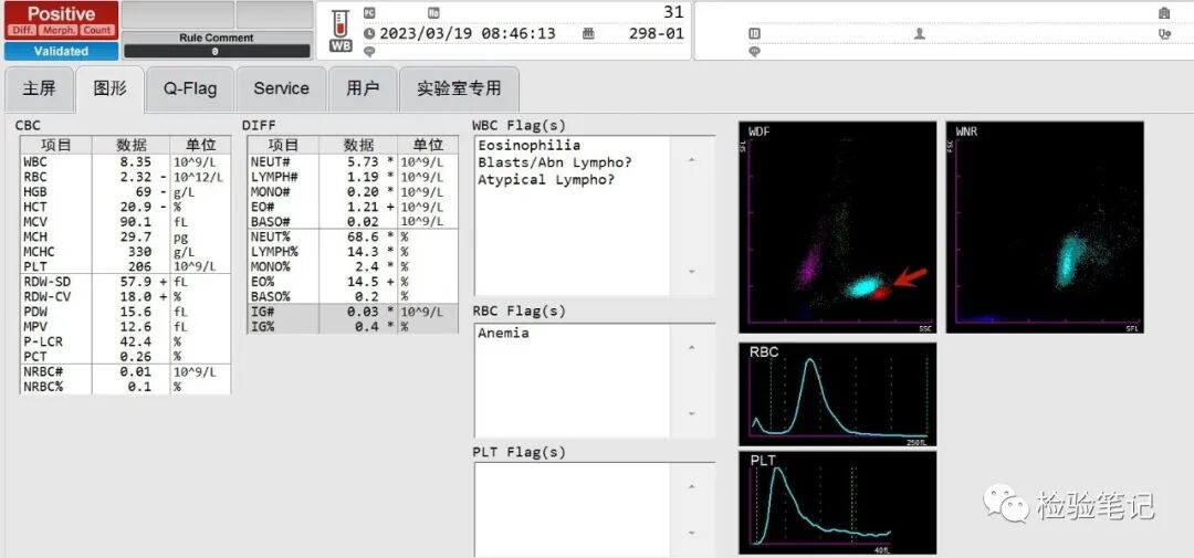 rbc直方图怎么看“实战演练”——用血常规散点图判断异常结果_https://www.jmylbn.com_新闻资讯_第10张