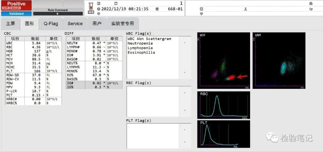 rbc直方图怎么看“实战演练”——用血常规散点图判断异常结果_https://www.jmylbn.com_新闻资讯_第13张