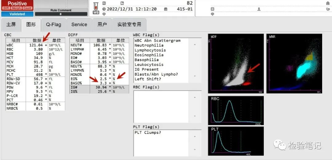 rbc直方图怎么看“实战演练”——用血常规散点图判断异常结果_https://www.jmylbn.com_新闻资讯_第19张