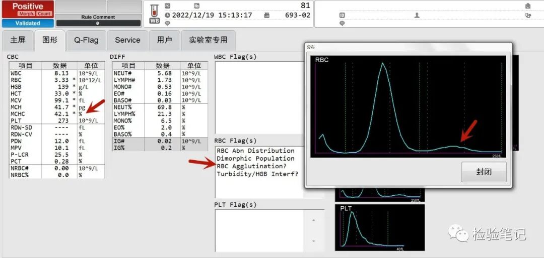 rbc直方图怎么看“实战演练”——用血常规散点图判断异常结果_https://www.jmylbn.com_新闻资讯_第12张