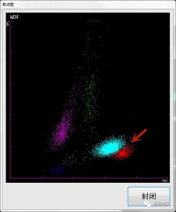 rbc直方图怎么看“实战演练”——用血常规散点图判断异常结果_https://www.jmylbn.com_新闻资讯_第11张