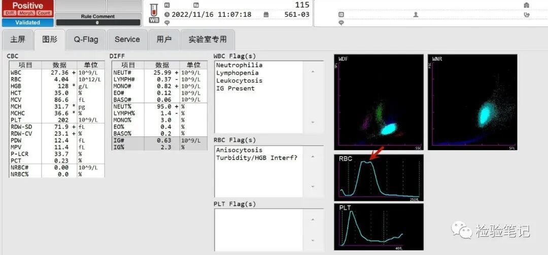 rbc直方图怎么看“实战演练”——用血常规散点图判断异常结果_https://www.jmylbn.com_新闻资讯_第3张