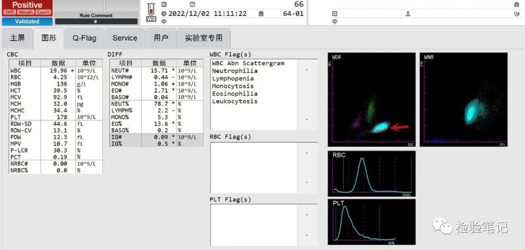rbc直方图怎么看“实战演练”——用血常规散点图判断异常结果_https://www.jmylbn.com_新闻资讯_第4张