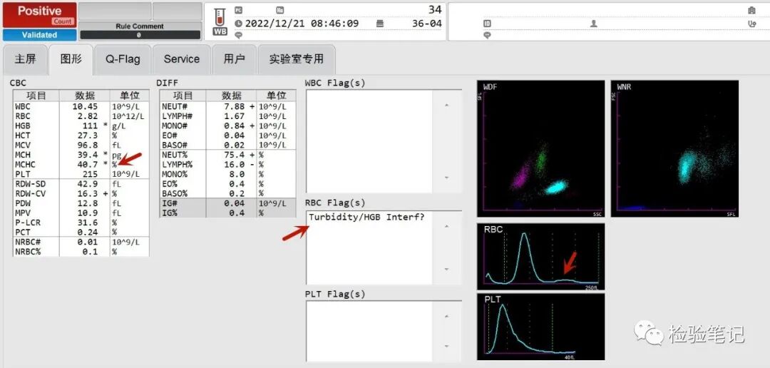 rbc直方图怎么看“实战演练”——用血常规散点图判断异常结果_https://www.jmylbn.com_新闻资讯_第17张
