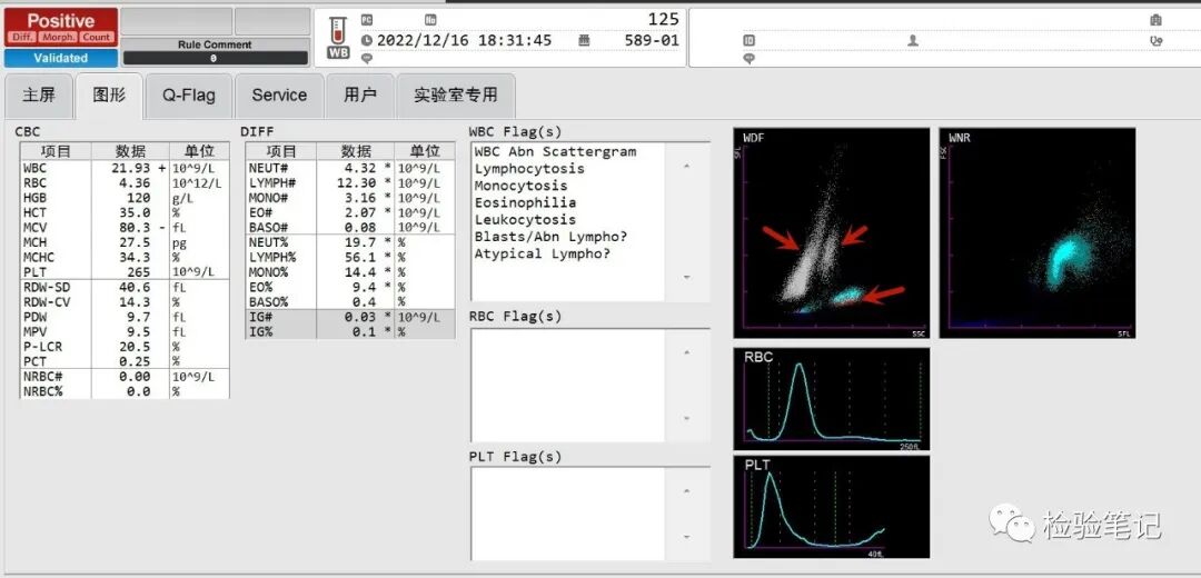 rbc直方图怎么看“实战演练”——用血常规散点图判断异常结果_https://www.jmylbn.com_新闻资讯_第7张