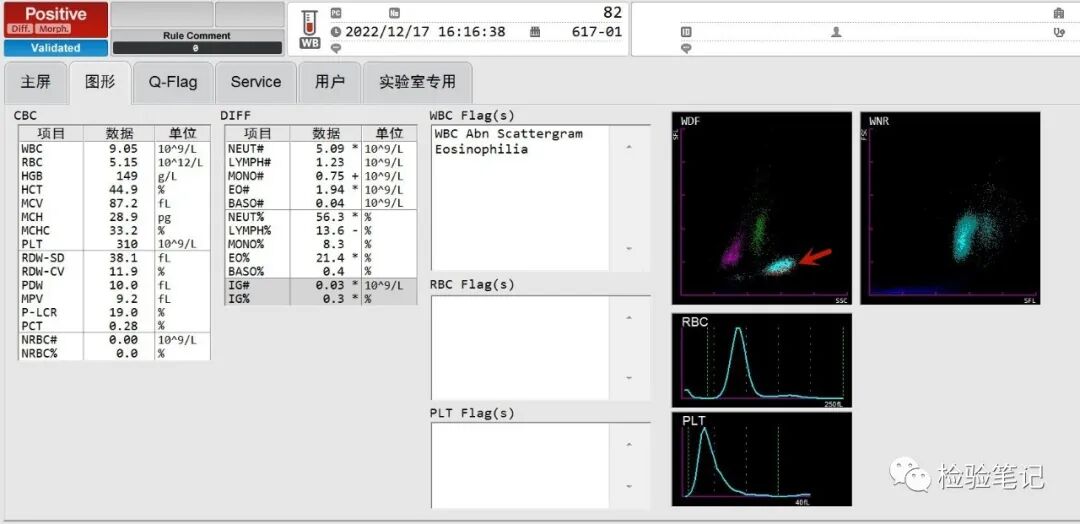rbc直方图怎么看“实战演练”——用血常规散点图判断异常结果_https://www.jmylbn.com_新闻资讯_第8张